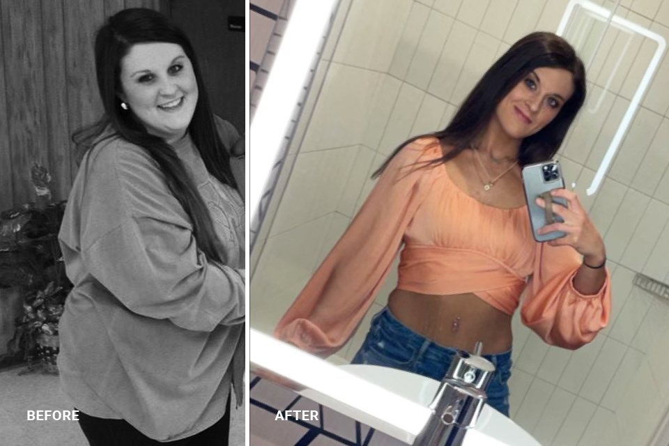 Anna-Garrett Nash before and after photos